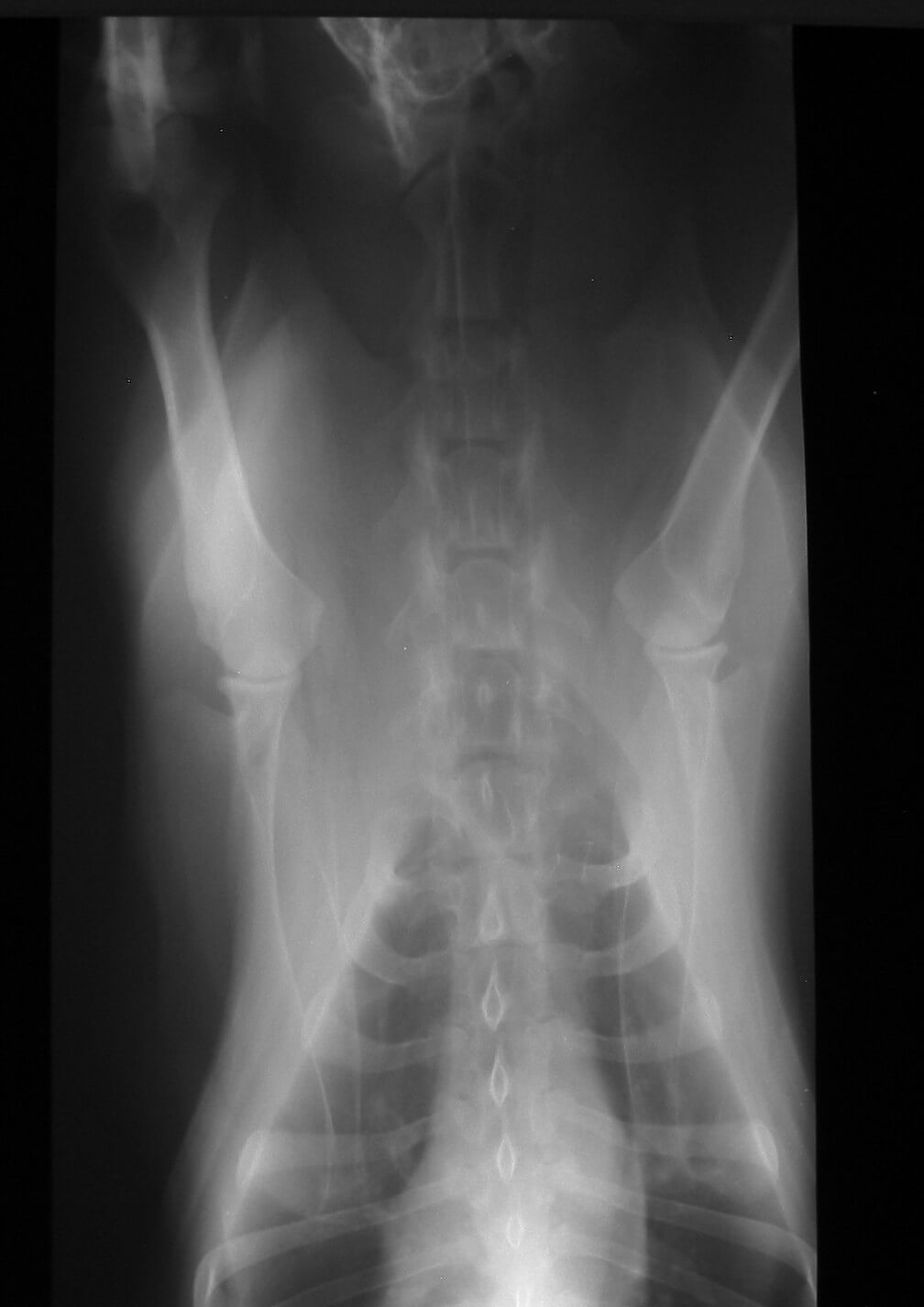 X-ray